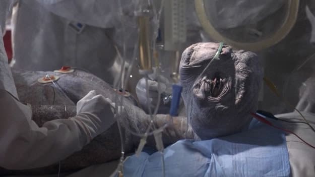 ET dying on the surgical table